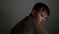 Bőr (Skin)